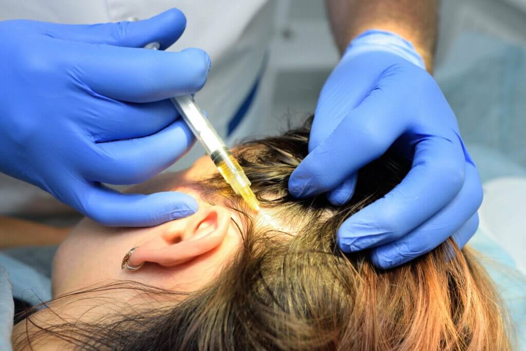HAIR RESTORATION WITH NATURAL GROWTH FACTOR INJECTIONS IN PHILADELPHIA, PA
