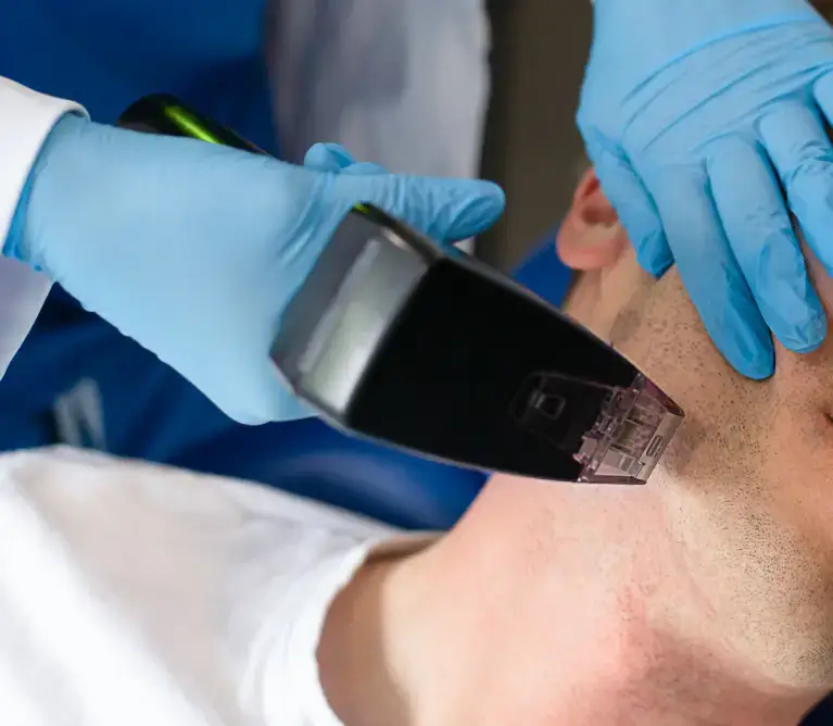 Hair Regenerative Medicine for Him