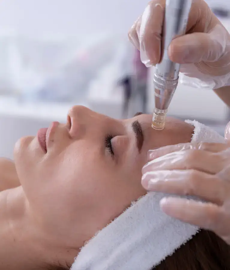 Microneedling in Philadelphia, PA