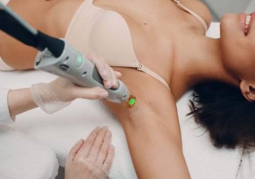 Laser Hair Removal for Her IN PHILADELPHIA